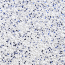 Thermoflex Media GlitterFlex Ultra 20" 1 Yd